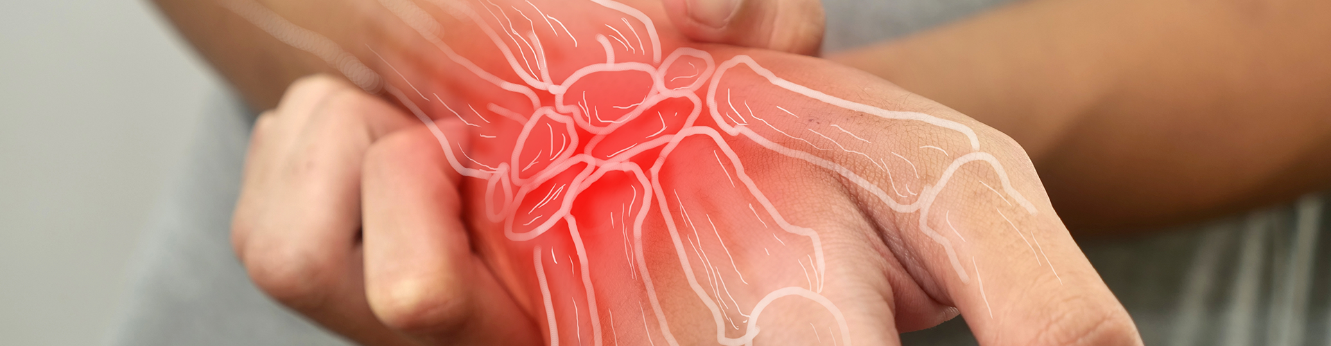 rheumatoid-arthritis