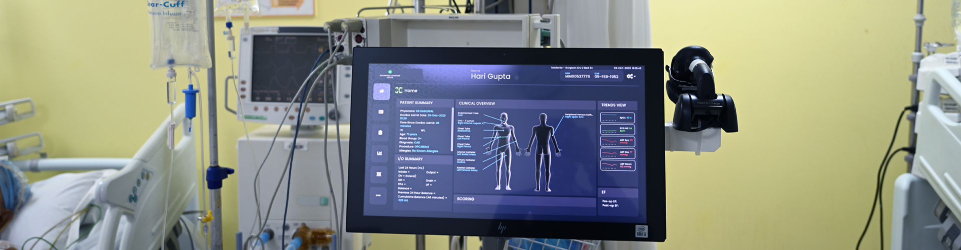 Advanced Hemodynamic Monitoring technology