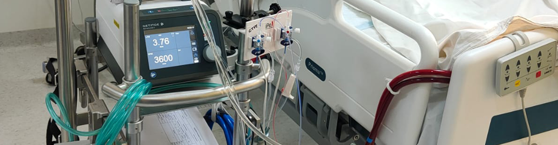 High-Frequency ventilation and ECMO