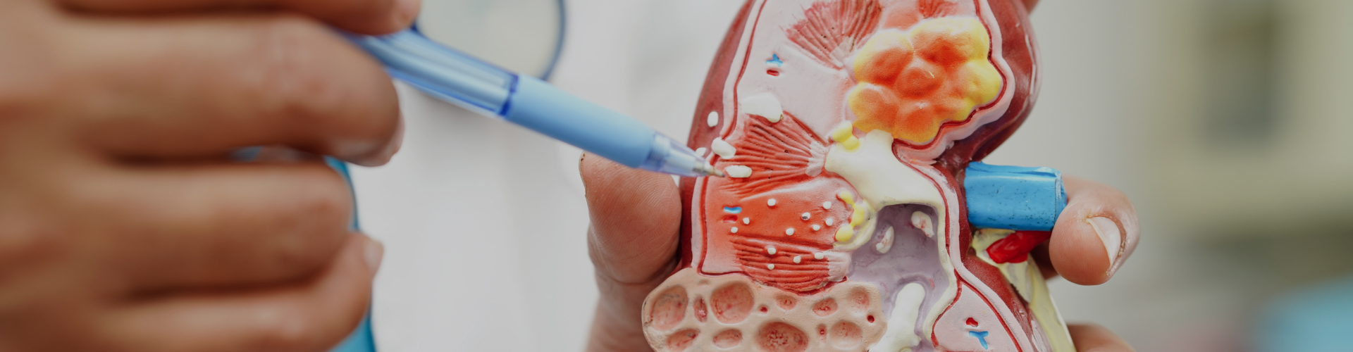 Glomerular Disease