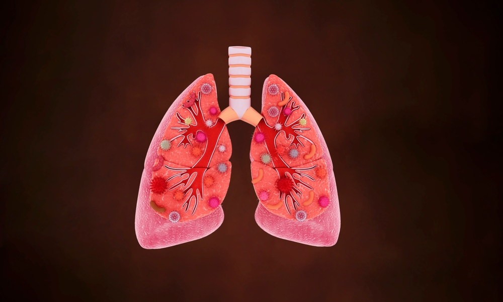 The Journey of Lung Cancer from Fatal to Manageable