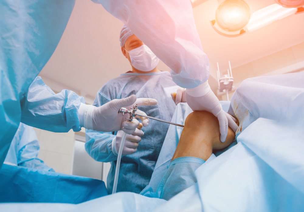 Arthroscopy Procedures