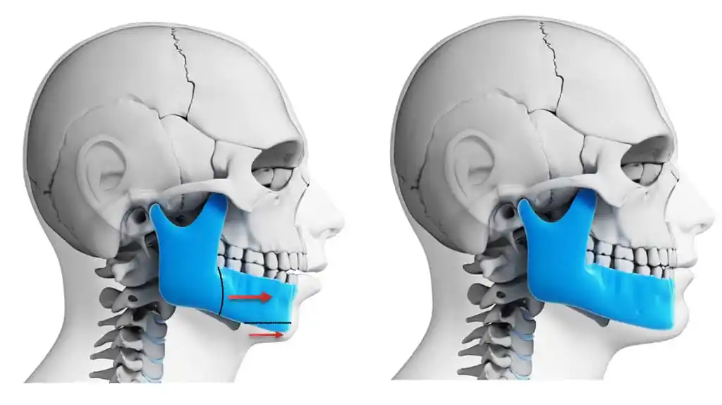 Gurgaon doctors reconstruct Delhi doctor's jaw using 3D technology