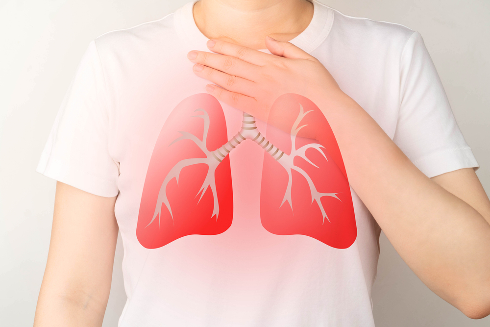 Acute respiratory distress syndrome