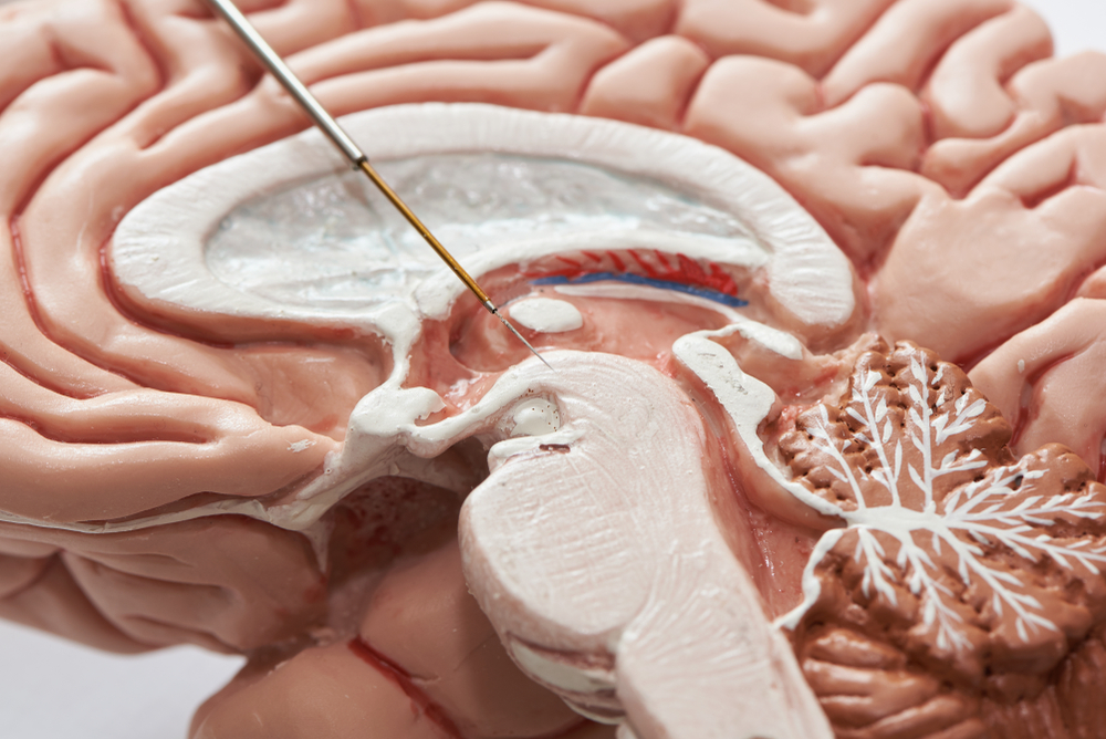 Deep Brain Stimulation (DBS)