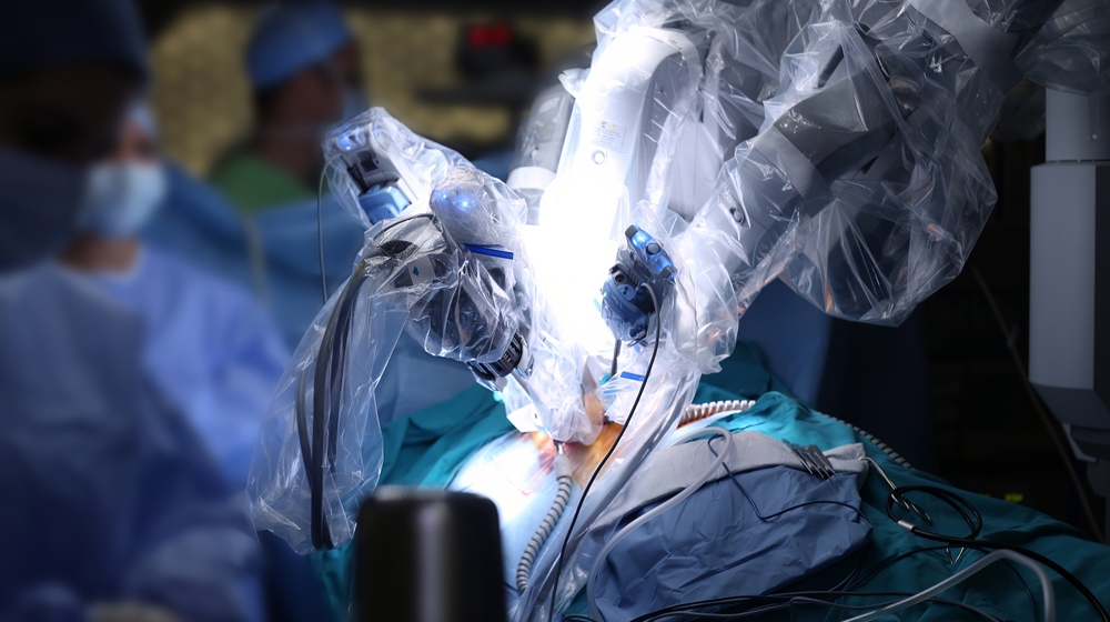 Robotic gastrointestinal (GI) surgery