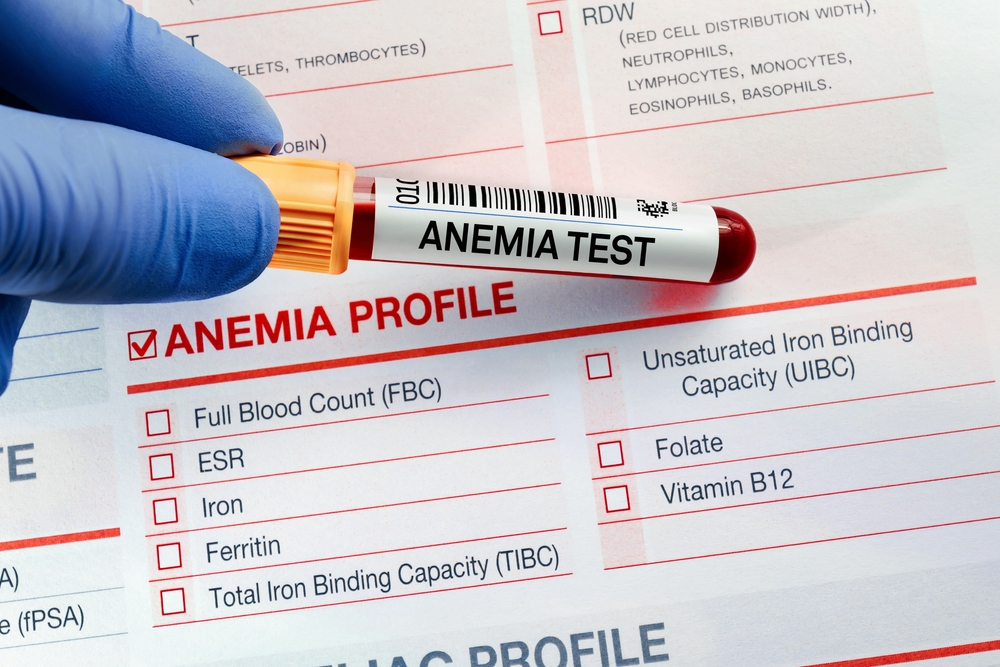 Severe aplastic anemia