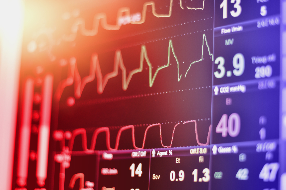 cardiac-resynchronization-therapy-crt