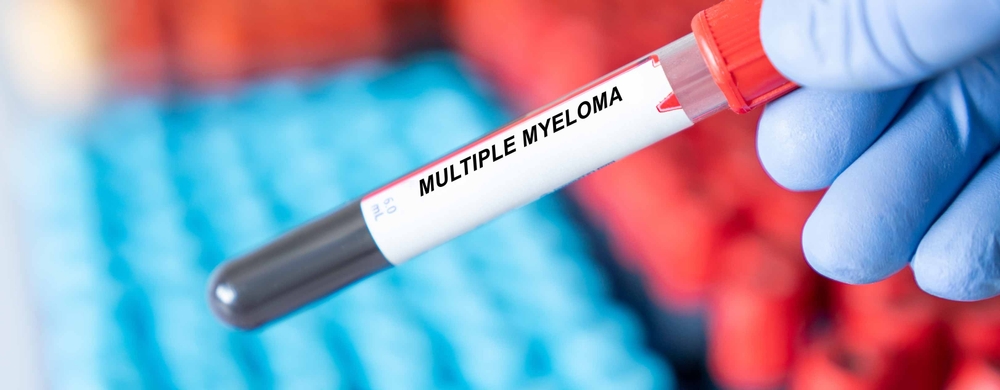 Multiple myeloma