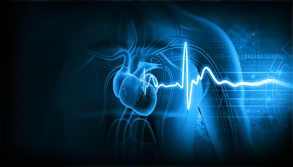 Atrial fibrillation (AFib)