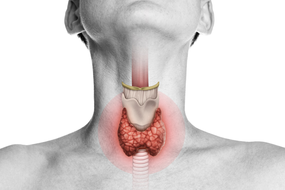 Esophagectomy