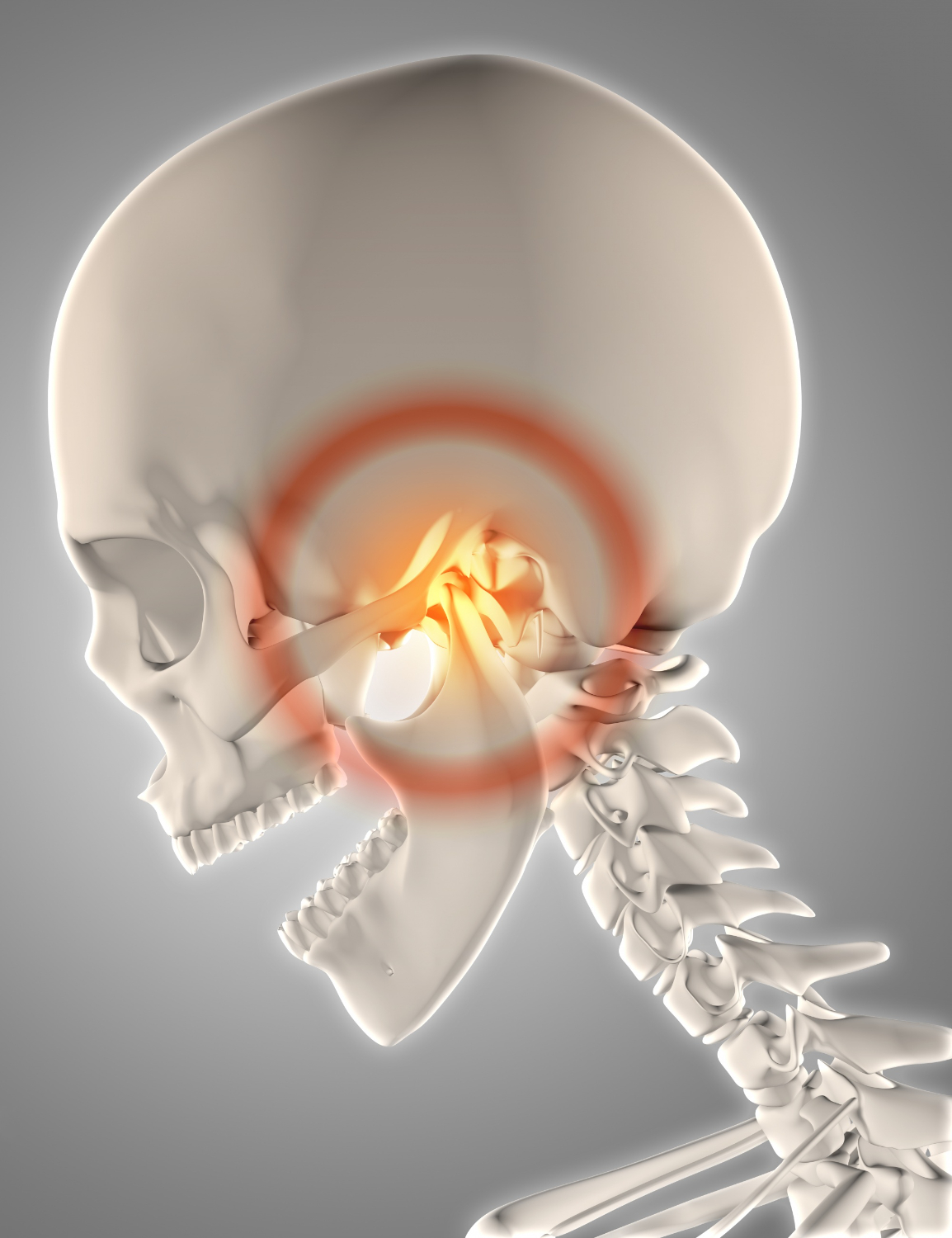 TM Joint Disorders and Myofacial Pain