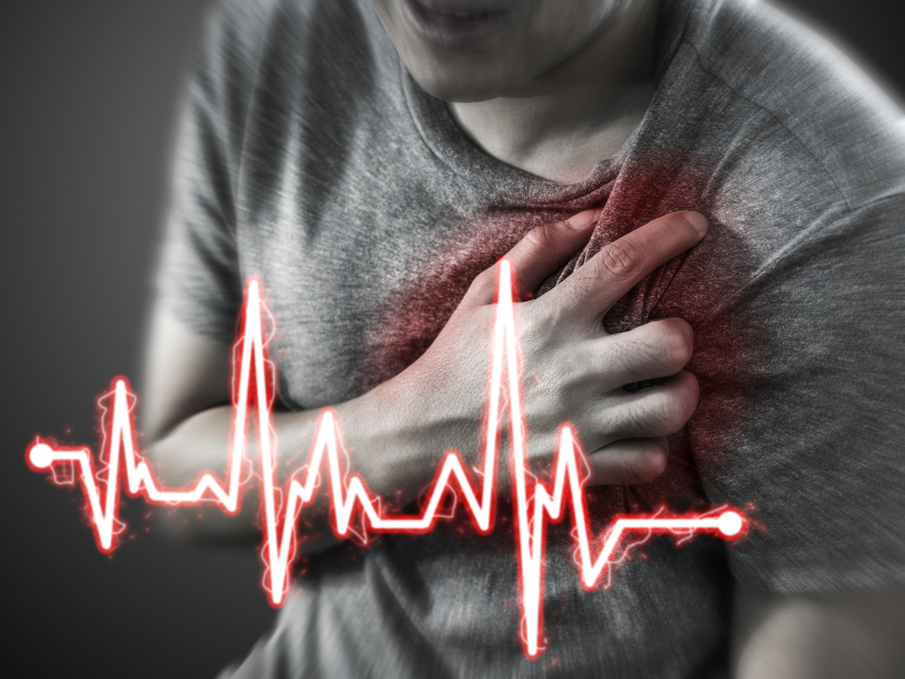 Ventricular tachycardia (VT)