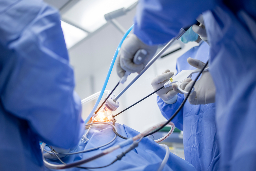 Minimally invasive surgery for GI cancer