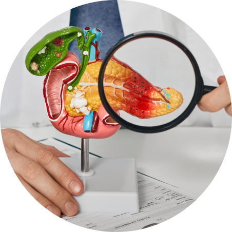 Upper gastrointestinal cancer