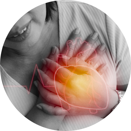 Ischemic Heart Disease