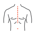 Chest Surgery