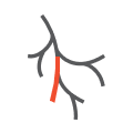 Peripheral Vascular and Endovascular Sciences