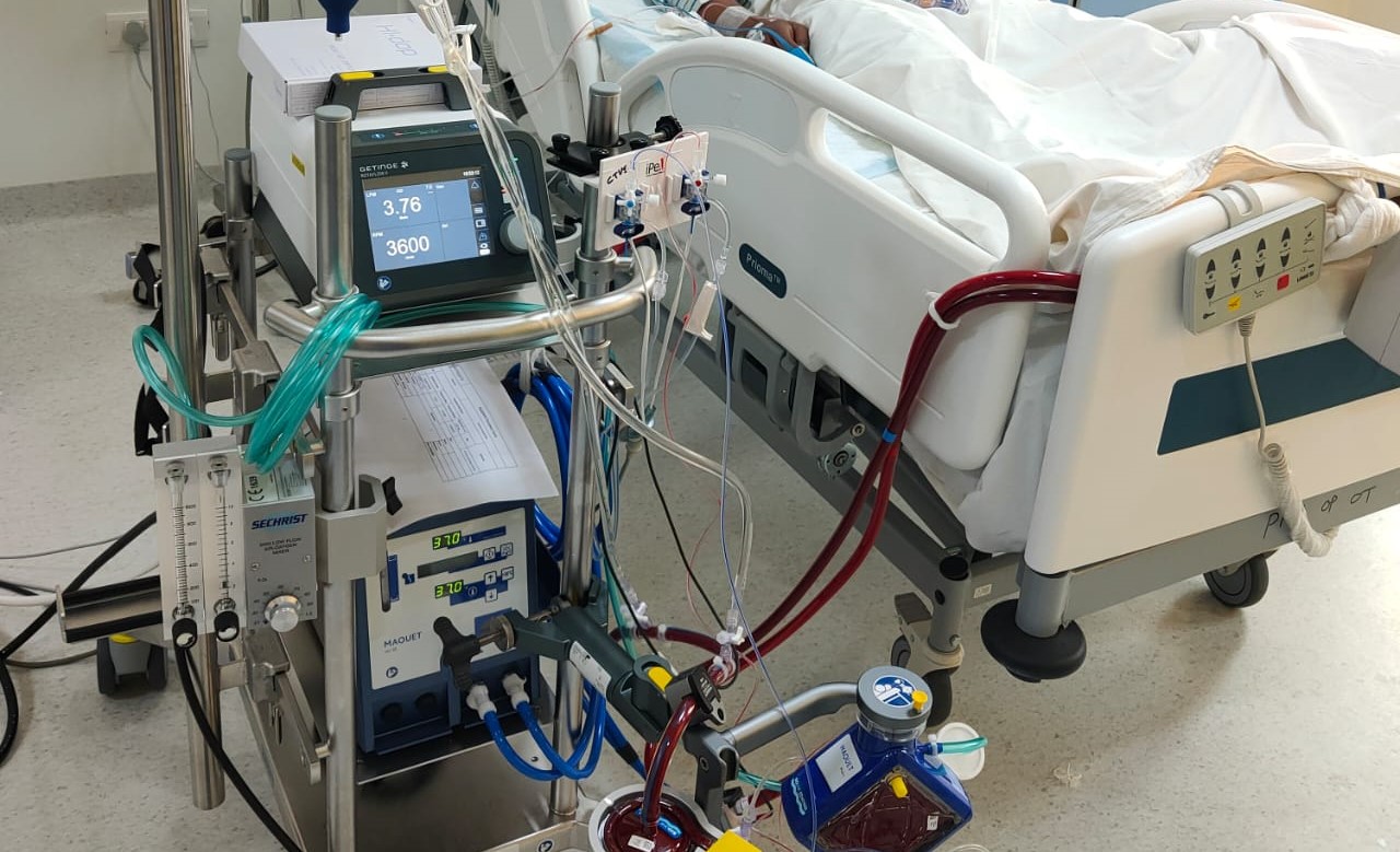 ECMO